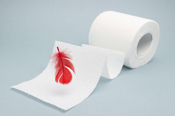 Blut auf Toilettenpapier ist ein Zeichen von Hämorrhoiden
